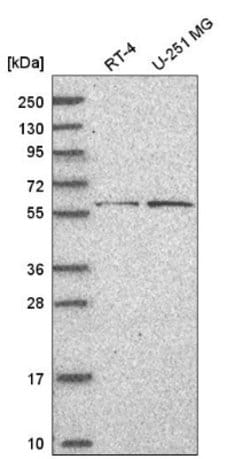 Bcl-6 Antibody, Novus Biologicals:Antibodies:Primary Antibodies